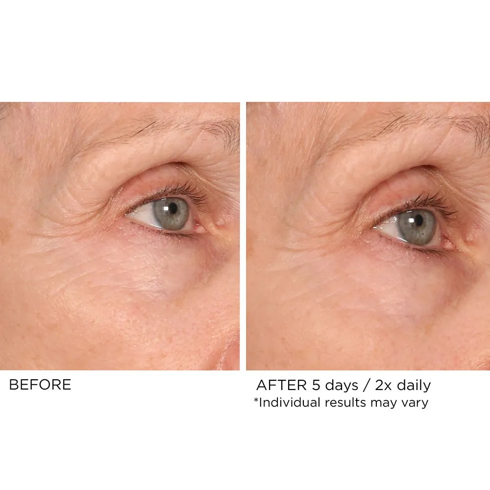 Eye Renewal Serum