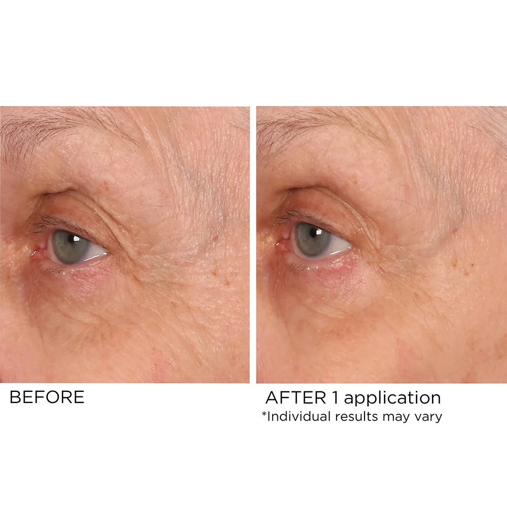 Eye Renewal Serum