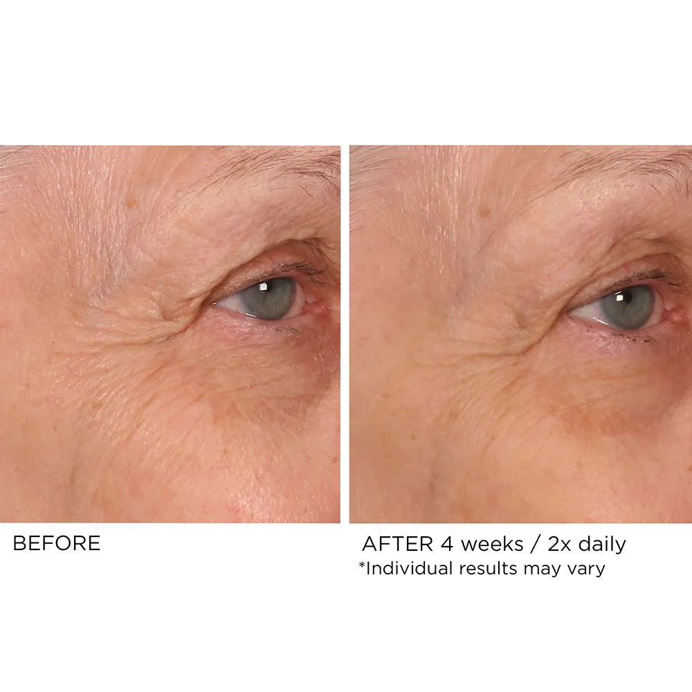 Eye Renewal Serum