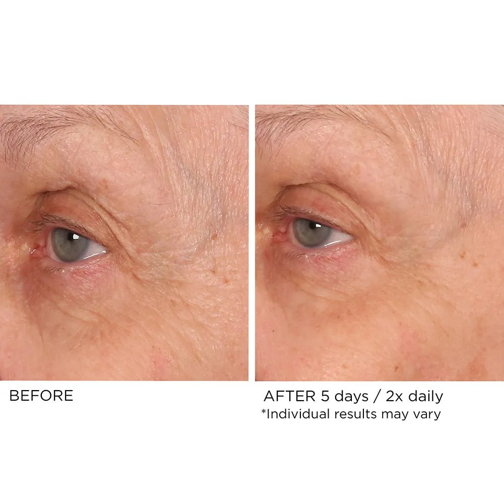 Eye Renewal Serum